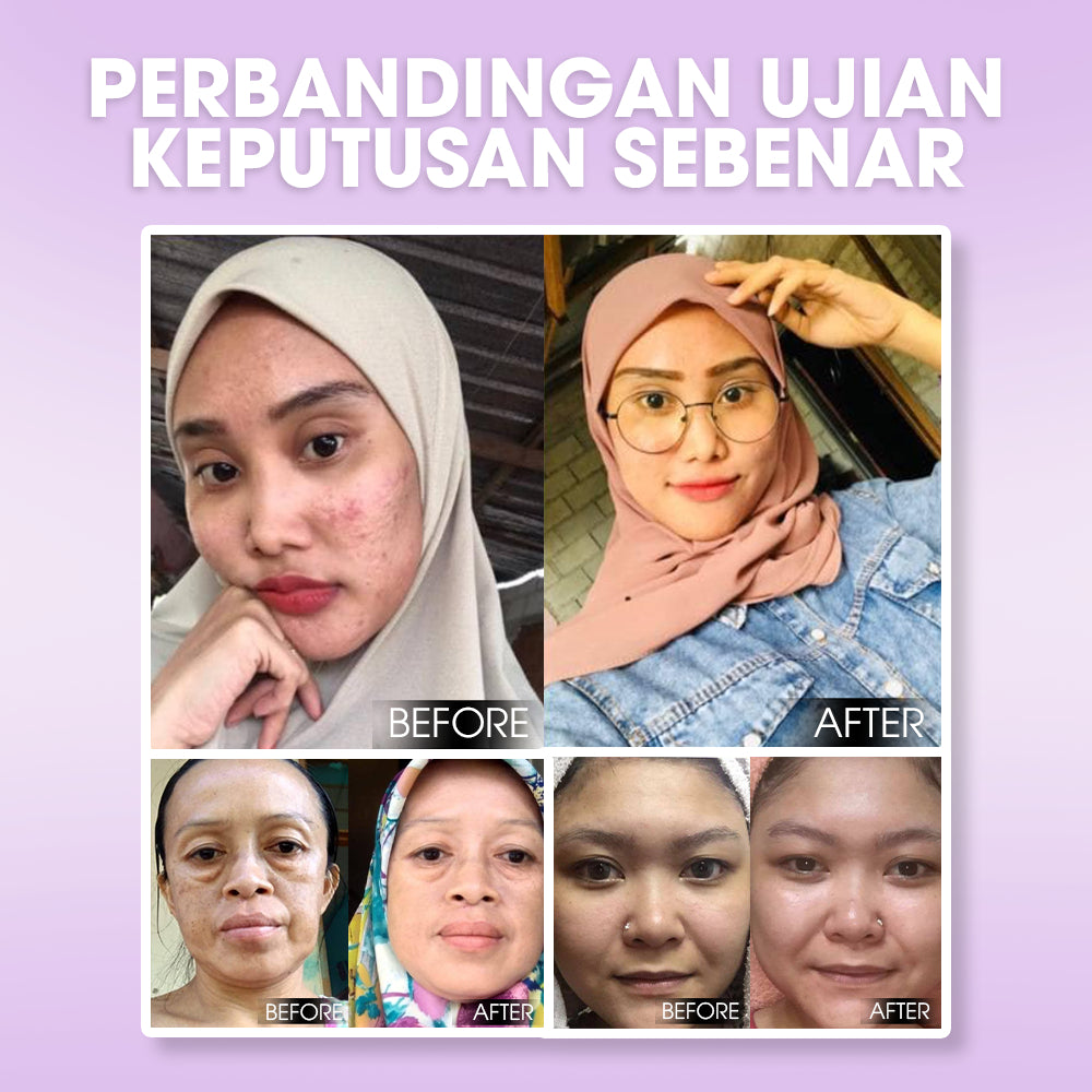 SEYOUL 21-day Skin Whitening Serum